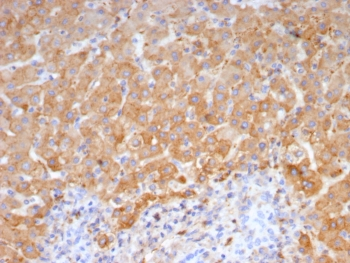 Haptoglobin Antibody