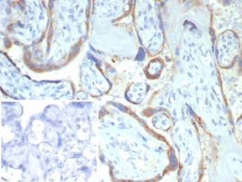 MMP2 Antibody