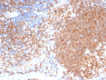PLK1 Antibody / Polo like kinase 1