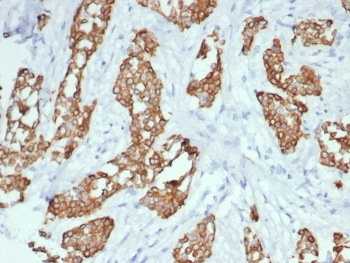 TrkC Antibody