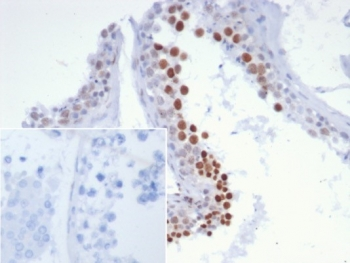 NUTM1 Antibody / NUT family member 1