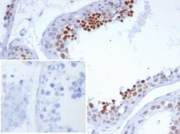 NUTM1 Antibody / NUT family member 1