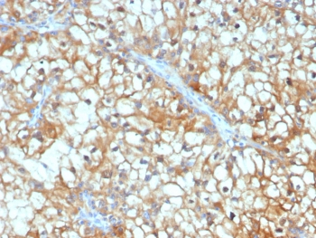 TGFB3 Antibody / TGF beta 3