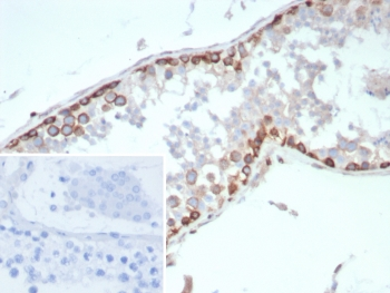 HIF1A Antibody / HIF-1 alpha