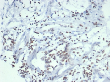 SULT1E1 Antibody / Estrogen Sulfotransferase
