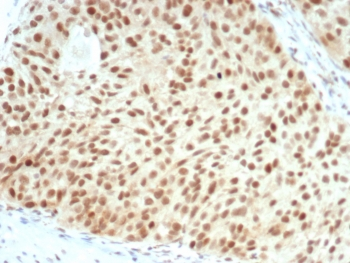 Retinoblastoma Antibody / Rb1