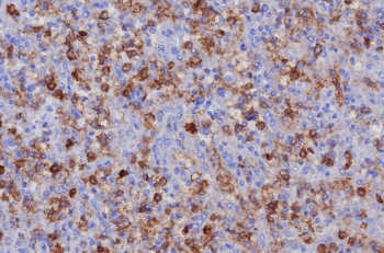 CD162 Antibody / P selectin glycoprotein ligand 1 / PSGL-1