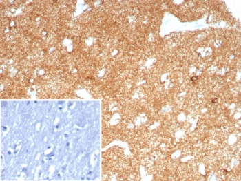 CD91 Antibody / LRP1 / A2MR