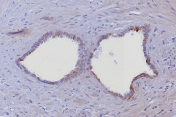 Keratin 6 Antibody / Cytokeratin 6