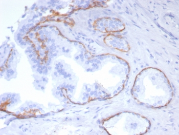 Cytokeratin 5 Antibody / KRT5