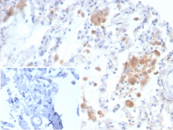 CD91 Antibody / LRP1 / A2MR