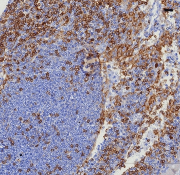 CD4 Antibody