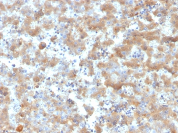 A2M Antibody / Alpha-2-Macroglobulin