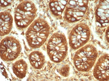 A2M Antibody / Alpha-2-Macroglobulin