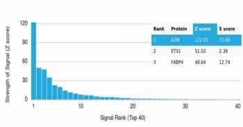 A2M Antibody / Alpha-2-Macroglobulin
