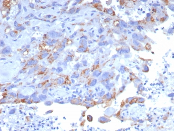 GPRC5A Antibody / Retinoic acid-induced protein 3 / PEIG-1