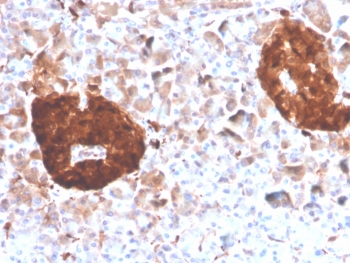NSE Antibody / Neuron Specific Enolase