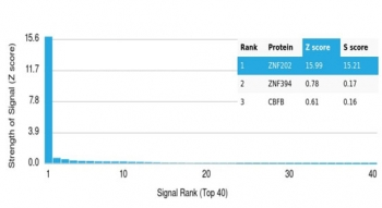 ZNF202 Antibody