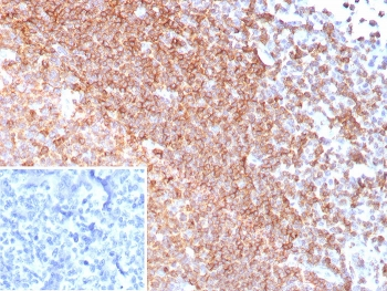 CXCR5 Antibody / BLR1 / MDR15