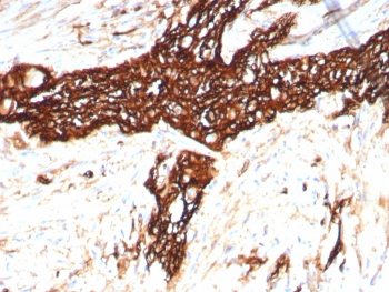 NCAM / CD56 Antibody