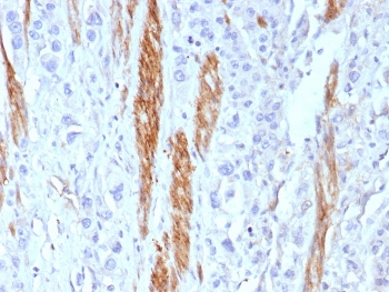 NCAM / CD56 Antibody