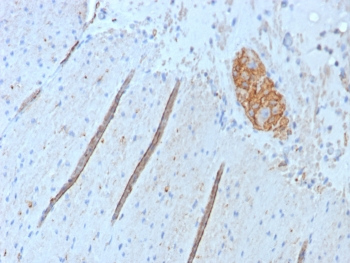 NCAM / CD56 Antibody