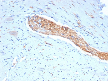 NCAM / CD56 Antibody