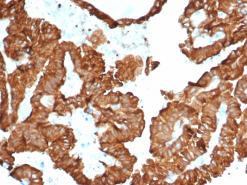 Alpha B Crystallin Antibody / CRYAB