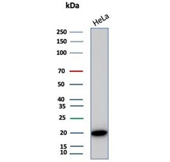 Alpha B Crystallin Antibody / CRYAB