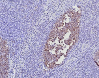POU2AF1 Antibody / BOB-1