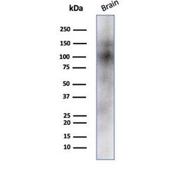 NCAM / CD56 Antibody
