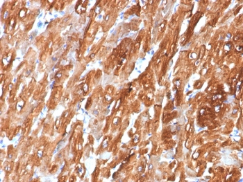 Alpha B Crystallin Antibody / CRYAB