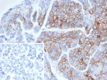 NCAM / CD56 Antibody