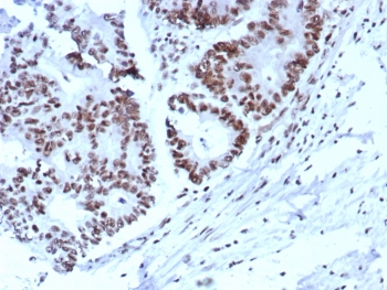 p57 Antibody / p57Kip2