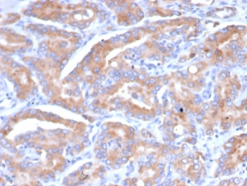 SI-CLP Antibody / CHID1 / Chitinase Domain Containing 1