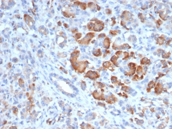 TRPC6 Antibody
