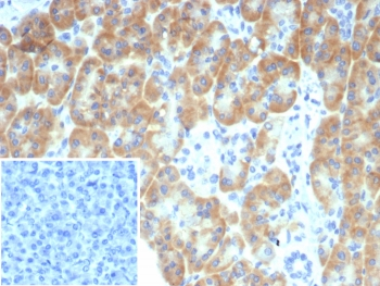 TRPC6 Antibody