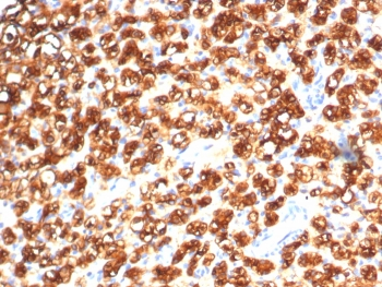 Tryptophan Hydroxylase Antibody / TPH1
