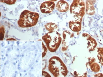 Tryptophan Hydroxylase Antibody / TPH1