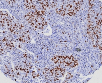 Ki-67 Antibody