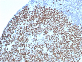 Ki-67 Antibody