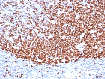 Ki-67 Antibody