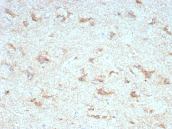 KChIP2 Antibody / KCNIP2