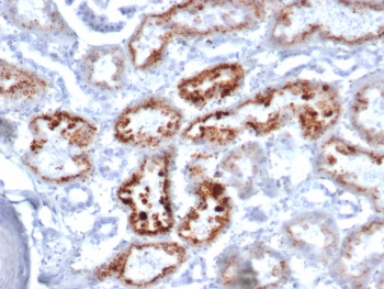 Retinol Binding Protein 4 Antibody / RBP4