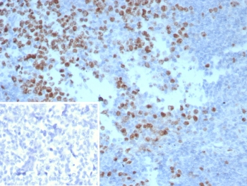 Ki-67 Antibody