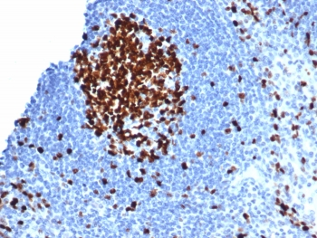 Ki-67 Antibody