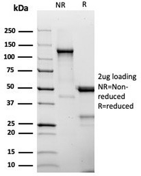 CD25 Antibody / IL2RA