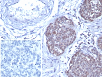 GATA3 Antibody