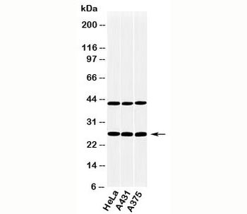 CLEC4E Antibody