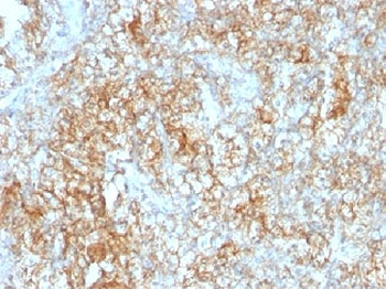 CD147 / Emmprin / Basigin Antibody